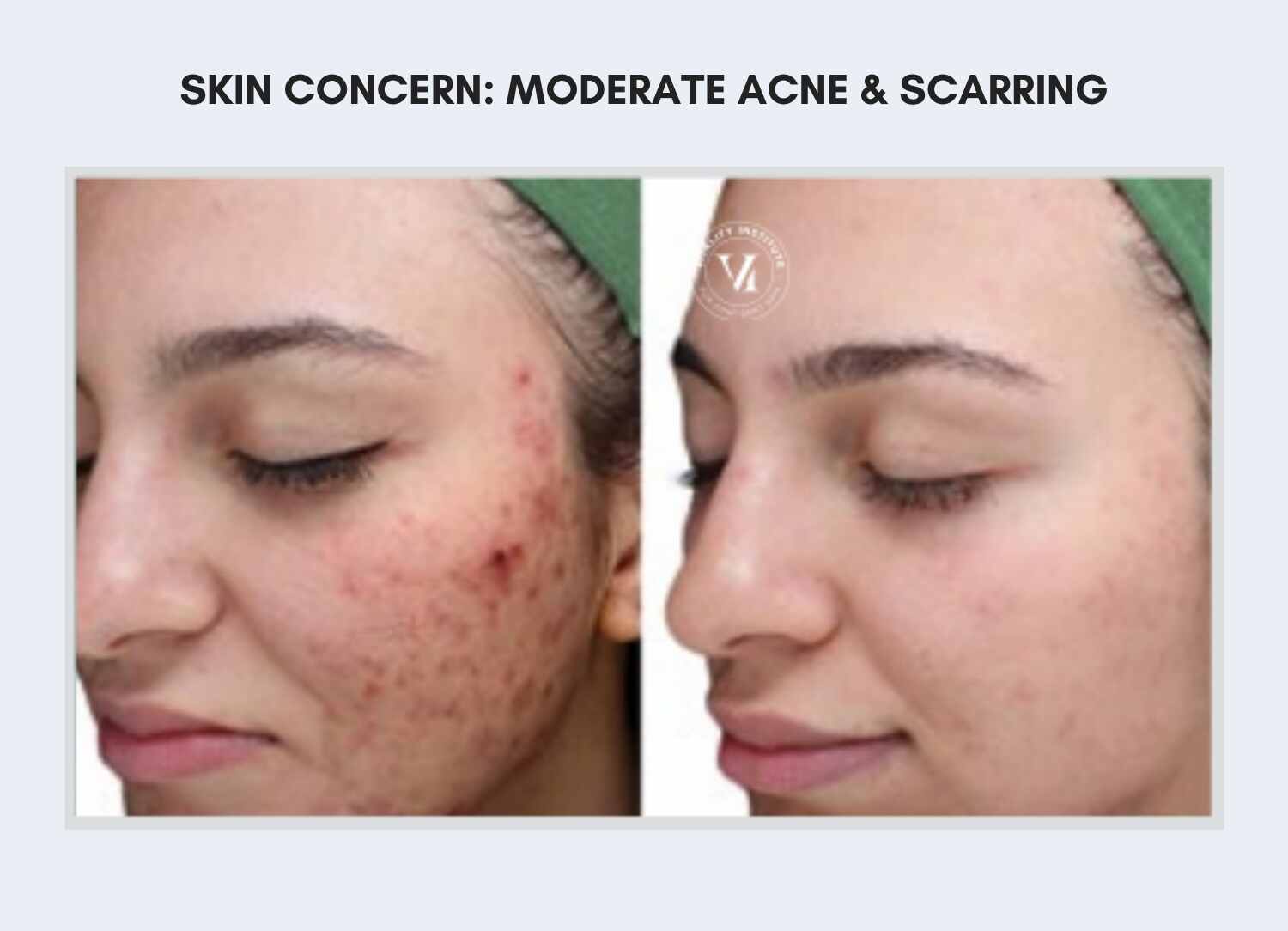 before and after before and after