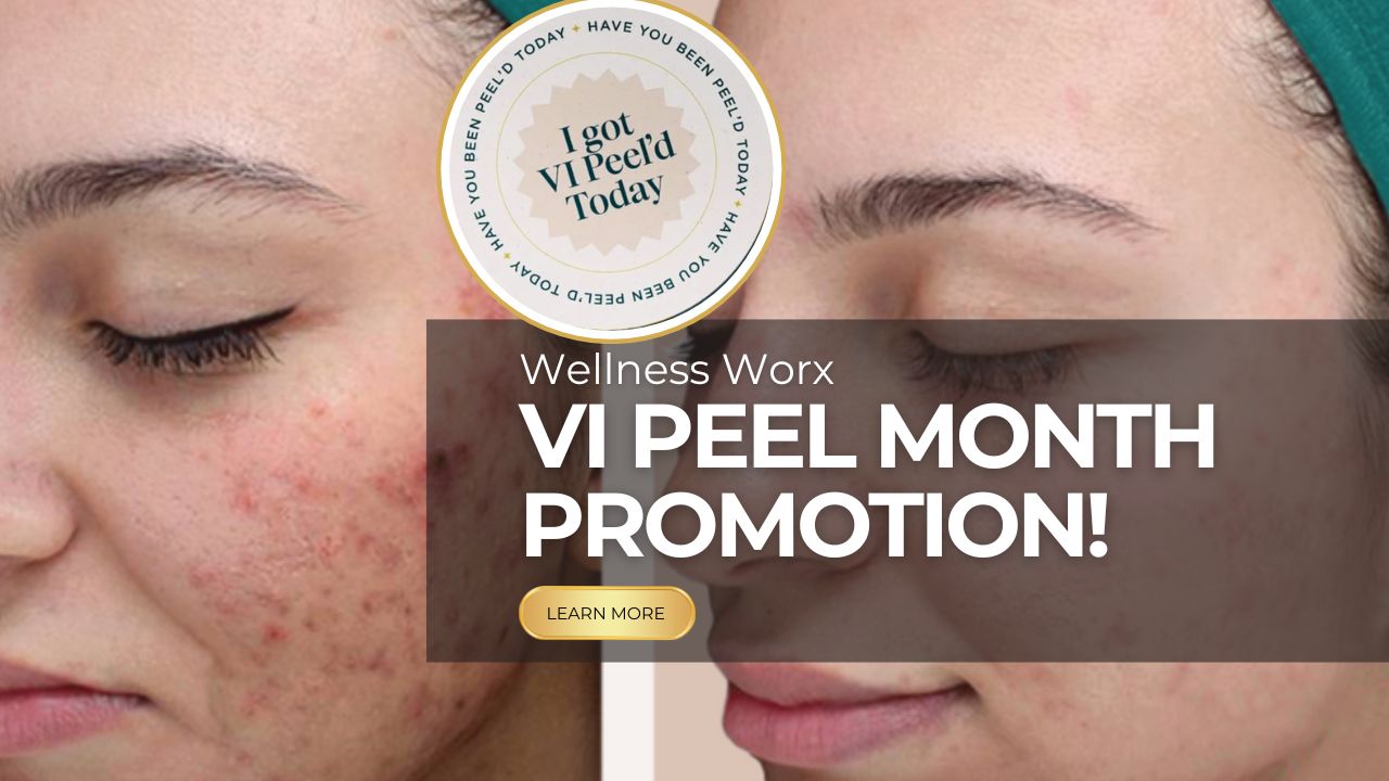 VI Peel Promotion