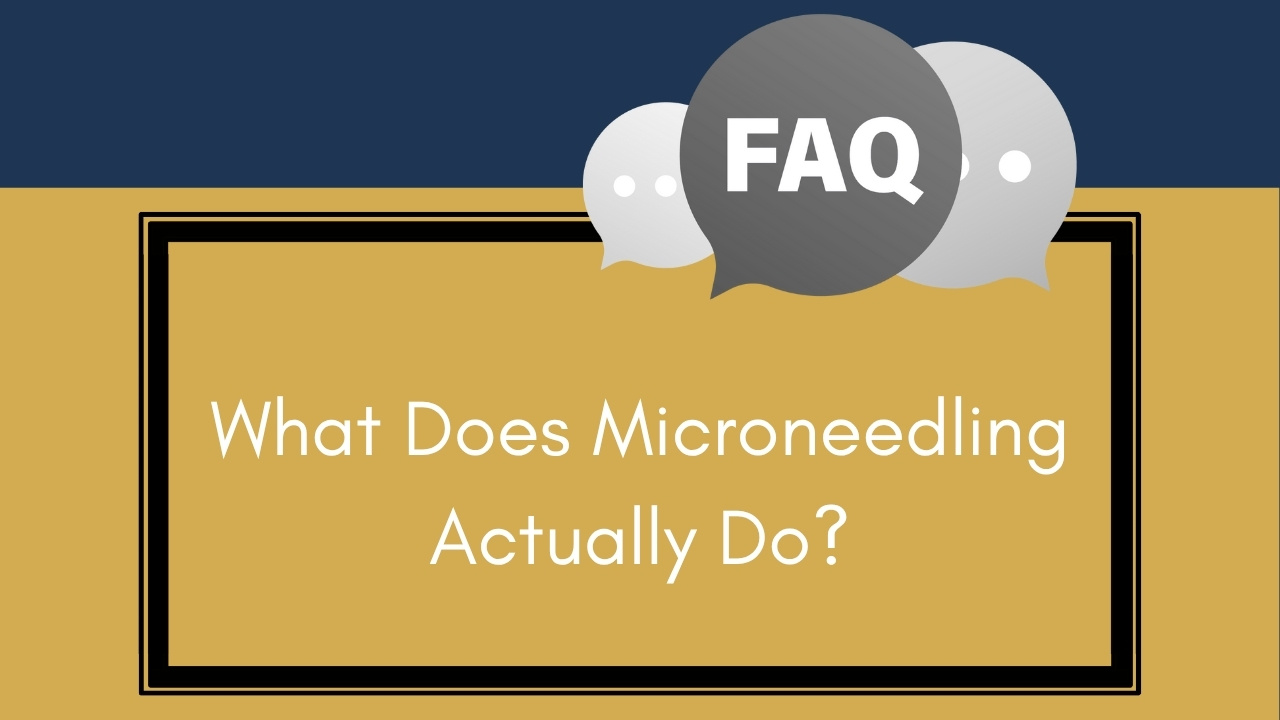microneedling